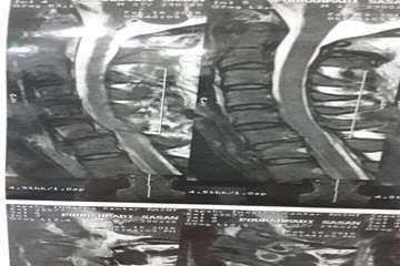 گرافی انجام شده در بیمارستان شهید بهشتی بندرانزلی
