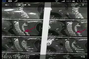 گرافی انجام شده در بیمارستان شهید بهشتی بندرانزلی