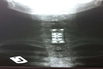 گرافی انجام شده در بیمارستان شهیدبهشتی بندرانزلی