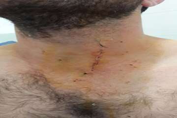 گرافی انجام شده در بیمارستان شهید بهشتی بندرانزلی