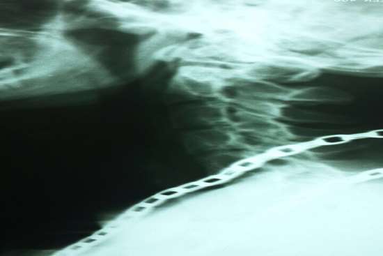 گرافی انجام شده در بیمارستان آستارا 5,